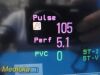 PHILIPS Intellivue MP50  , MMS Press Print Modules, Leads~ Anesthesia Monitor