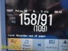 PHILIPS Intellivue MP50  , MMS Press Print Modules, Leads~ Anesthesia Monitor
