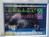 PHILIPS Intellivue MP50  , MMS Press Print Modules, Leads~ Anesthesia Monitor