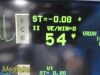 SPACELABS 91370 Ultraview SL,W/ Leads, 91496 Module & PSU ~ Patient Monitor