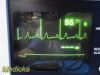 WELCH ALLYN 6200 Series, W/ ECG,SpO2,NBP Leads & Printer ~  Patient Monitor