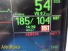 GE Dash 3000 Series,(SpO2 Dual IBP EKG NBP T/CO Print) W/ Leads ~ Monitor