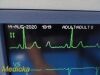 GE Dash 4000 Series (PRINT T/CO CO2 EKG NBP SpO2 Nellcor) Monitor