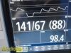 PHILIPS 2016  Intellivue MP5SC Spot Check Monitor