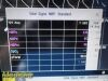PHILIPS 2016  Intellivue MP5SC Spot Check (TEMP SPO2 NBP) W/ Leads~ Monitor