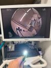 FUJINON EC-530WI3 Colonoscope
