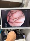 FUJINON EC-530WI3 Colonoscope