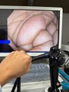 OLYMPUS CF-H170L Colonoscope