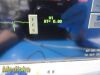 SPACELABS 91370 Ultraview SL,W/ 90496 Module, PSU & Leads ~  Patient Monitor