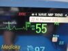 PHILIPS Intellivue MP30 (M8002A)  Anesthesia Monitor