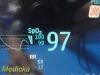 PHILIPS Intellivue MP30 (M8002A) Anesthesia Monitor