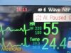 PHILIPS Intellivue MP50 ,W/ Leads & MMS/Press/Print Modules~Patient Monitor