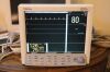 DATASCOPE Mindray Spectrum Bedside Monitor