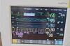 PHILIPS IntelliVue MP20 Monitor