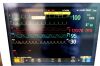 PHILIPS MP70 Monitor