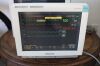 PHILIPS MP70 Monitor