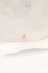 BARD 1820MSK | | SHORT DATE | EACHES | Mission Disposable Core Biopsy Kit 18G x 20cm