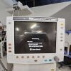 GE Engstrom carestation Ventilator