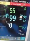 PHILIPS Intellivue MP30 (M8002A) Patient Monitor
