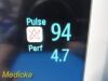 PHILIPS Intellivue MP30 (M8002A) Patient Monitor