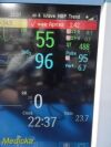 PHILIPS MP50, W/ Leads & BIS;Press;MMS;Print Modules ~  Critical Care Monitor