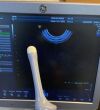 GE RIC5-9W-RS Ultrasound Transducer