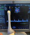 GE RIC5-9W-RS Ultrasound Transducer