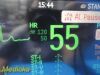 PHILIPS Intellivue MP50 Critical Care,W/ MMS CO IBP Print Modules~ Monitor