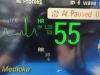 PHILIPS Intellivue MP70 ,W/ MMS & Print Modules + Leads ~ Neonatal Monitor