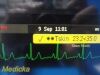 PHILIPS Intellivue MP70 ,W/ MMS & Print Modules + Leads ~ Neonatal Monitor