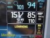 GE 2013  Dash 4000 Series  ,(TEMP/CO, SpO2, ECG, NBP Print) W/ Leads~ Monitor