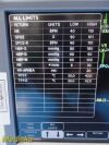 GE 2013  Dash 4000 Series  ,(TEMP/CO, SpO2, ECG, NBP Print) W/ Leads~ Monitor