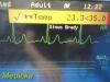 PHILIPS Intellivue MP50 Anesthesia, W/ MMS Print IBP Module & Leads~ Monitor