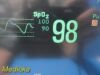 PHILIPS Intellivue MP50 Anesthesia, W/ MMS Print IBP Module & Leads~ Monitor