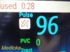 PHILIPS MP70,W/ Leads & Extension/MMS/Recorder Modules  Anesthesia Monitor