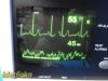 WELCH ALLYN Protocol 6200 Series Patient Monitor