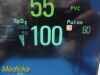 PHILIPS Intellivue MP50 Anesthesia Patient Monitor