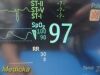 PHILIPS Intellivue MP50 CRITICAL CARE Monitor