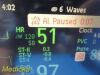 PHILIPS Intellivue MP50 CRITICAL CARE Monitor