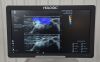 SUPERSONIC Hologic  Mach 20 Ultrasound System 2021 W/  L18-5 Transducer SSIP 95100 - 190448 Mach 20