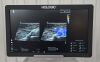 SUPERSONIC Hologic  Mach 20 Ultrasound System 2021 W/  L18-5 Transducer SSIP 95100 - 190448 Mach 20