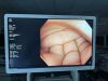 OLYMPUS CF-HQ290L Colonoscope
