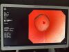 OLYMPUS CF-Q260DL Colonoscope