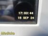SPACELABS 91369 Ultraview SL , W/ Module, NEW Leads & PSU ~ Patient Monitor