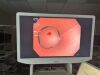 OLYMPUS CFH190L Colonoscope