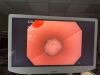 OLYMPUS GIF-1TH190 Gastroscope