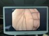 OLYMPUS PCFH190DL Colonoscope