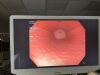 OLYMPUS PCFH190DL Colonoscope