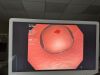 OLYMPUS PCFH190DL Colonoscope
