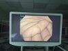 OLYMPUS GIF-H180 Gastroscope